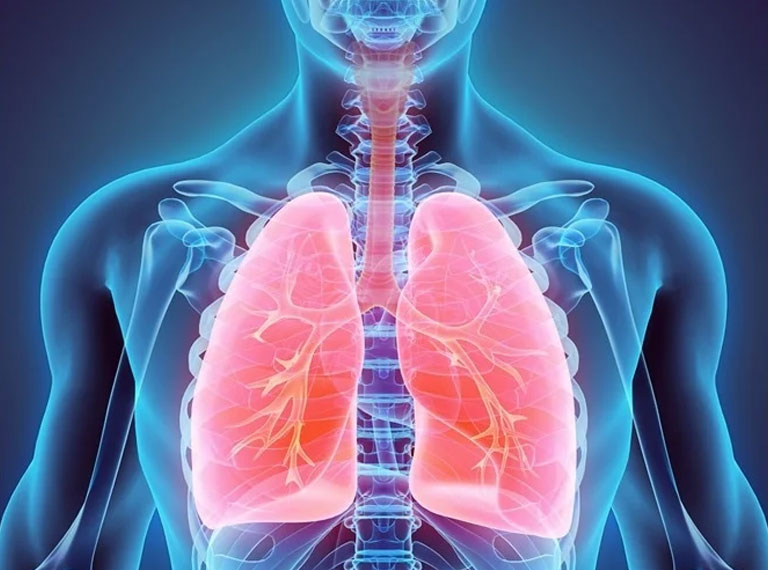 chronic obstructive pulmonary disease causes